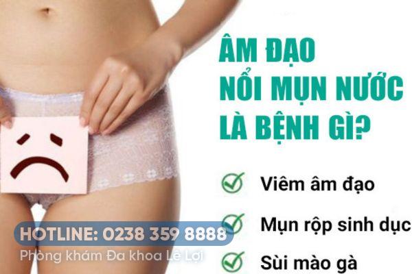 Mụn nước âm đạo là dấu hiệu bệnh gì?