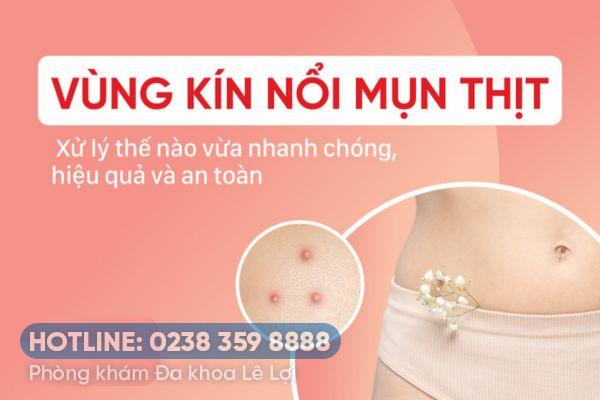 Mụn thịt âm đạo do mắc bệnh gì?