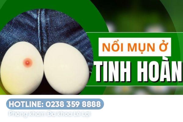 Lý do nam giới bị nổi mụn trắng tinh hoàn