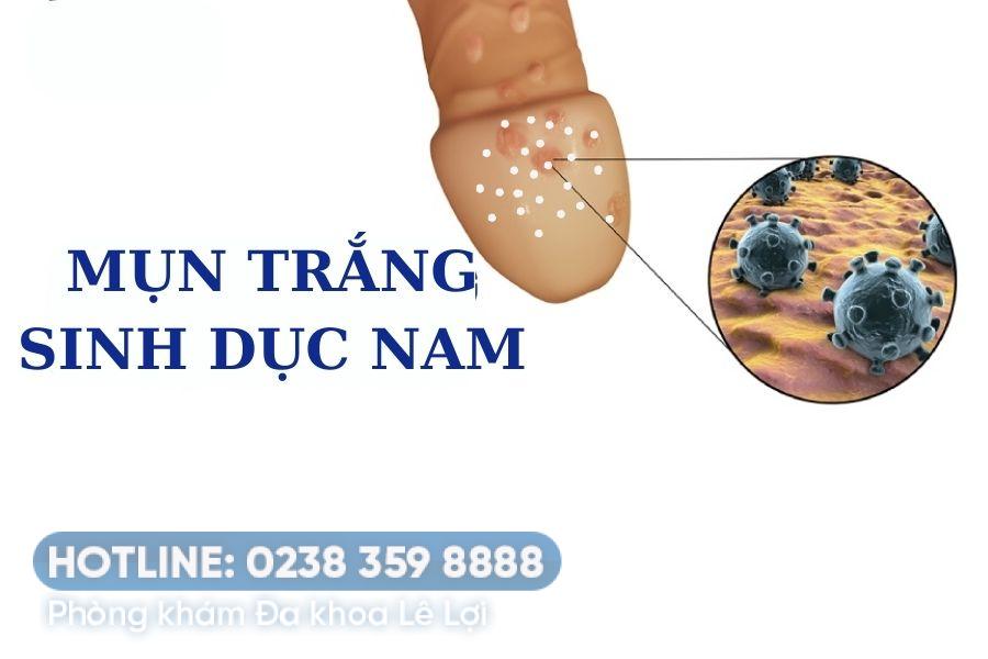 Nổi mụn trắng ở nam và cách điều trị hiệu quả