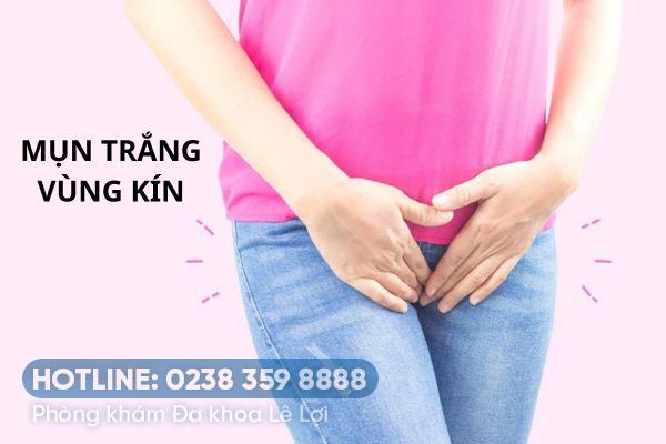 Vùng kín nổi mụn trắng li ti là bị bệnh gì?