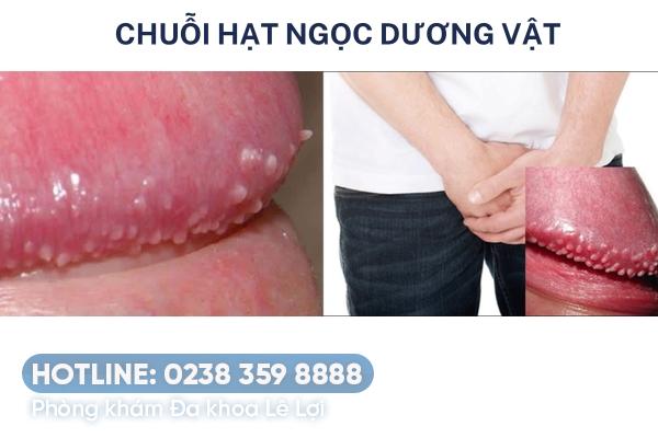 nguyen-nhan-mun-thit-duong-vat