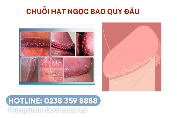 chuoi-hat-ngoc-bao-quy-dau