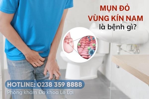 Mụn đỏ vùng kín nam nguy hiểm không?