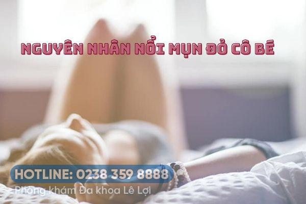 Nổi mụn đỏ cô bé và những điều cần lưu ý