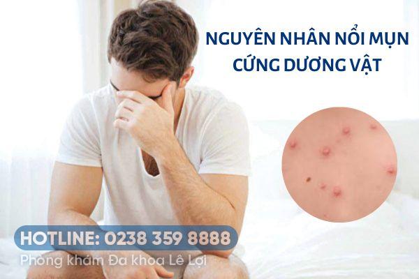 Nổi mụn cứng dương vật là do đâu?