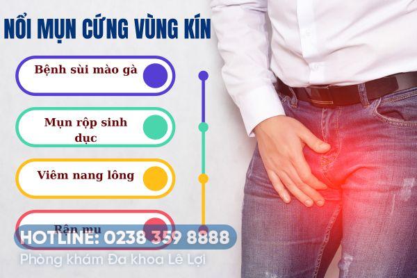 Cách trị mụn cứng ở vùng kín hiệu quả