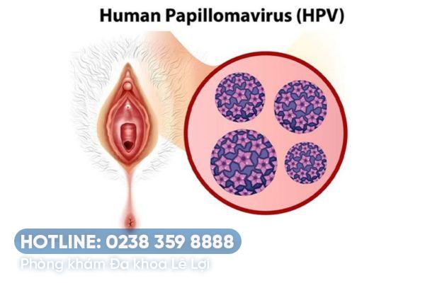 Mụn sần âm đạo có phải là dấu hiệu bệnh?