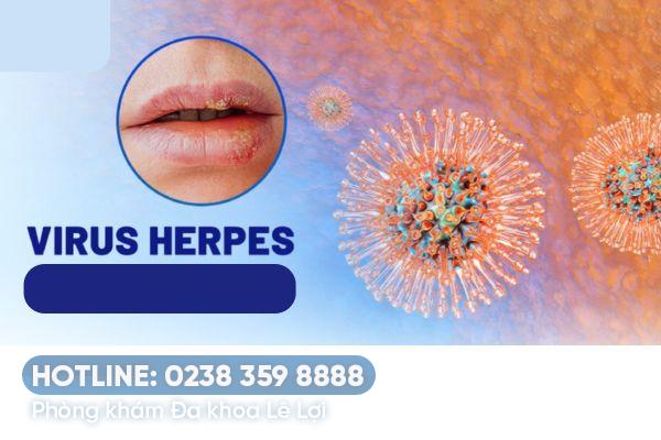 Bệnh Herpes miệng có nguy hiểm không?