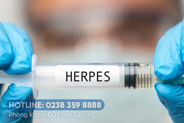 Phí xét nghiệm Herpes là bao nhiêu?